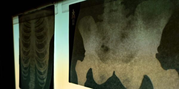 X-Rays-From-Santa-Set-Design