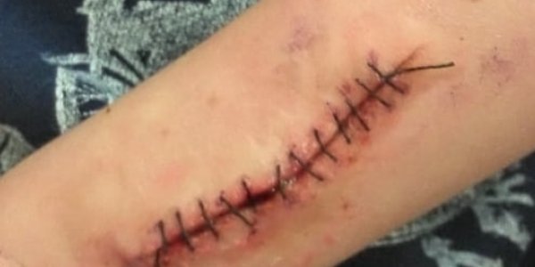 SFX-Halloween-Makeup-Artists-Stitched-Arm